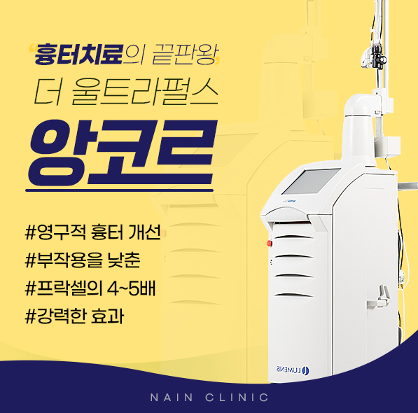앙코르